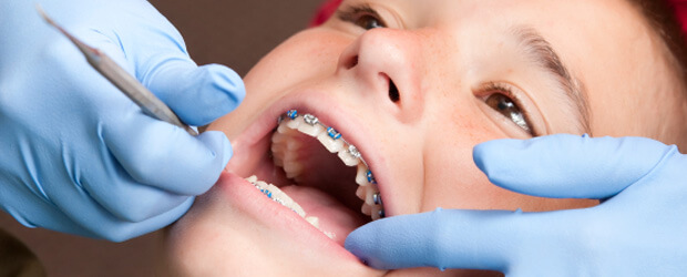 Glebe_Dental_Orhtodontics_braces