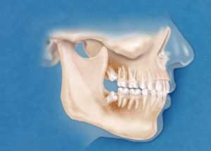 Orthodontics, Glebe, Sydney | Glebe Dental Group